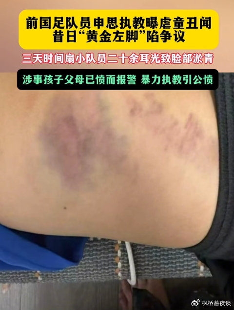 禁足令成空文？申思事件撕开中国足球监管体系的深层病灶！